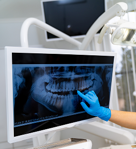 Dental Treatment