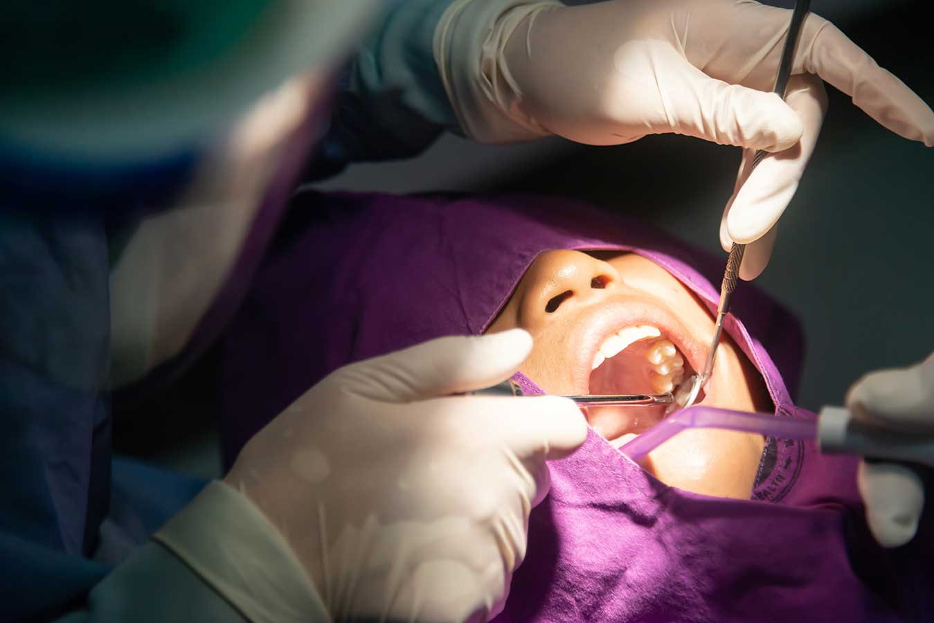 Surgical Extraction