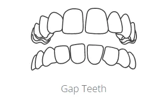 Gap teeth