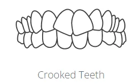 crooked teeth