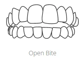 opne bite