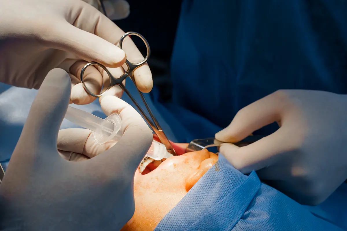 Gum Surgery
