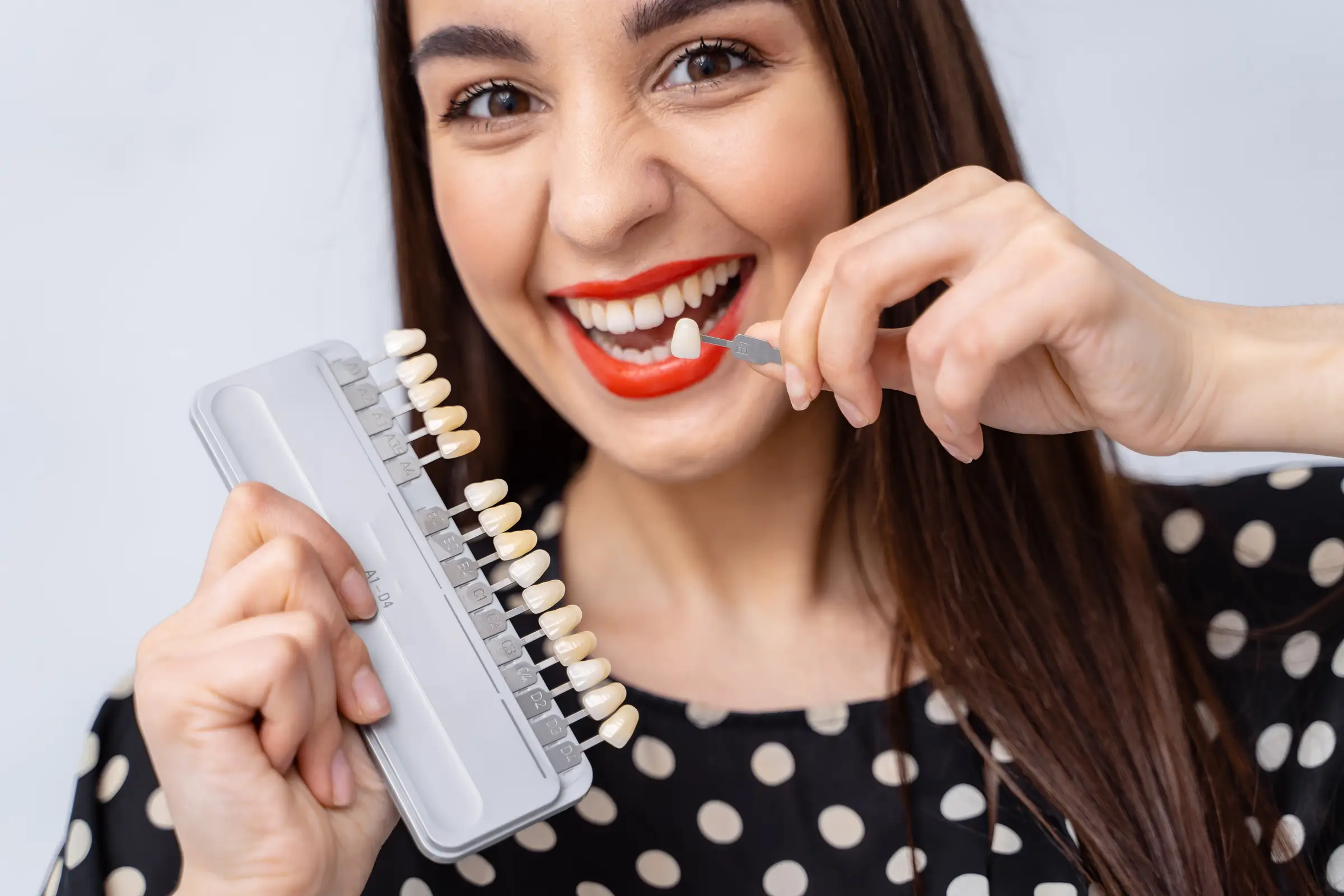 At-Home Tooth Whitening